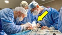 The woman turned with kidney pain! But, THE SURGEONS did not believe THEIR EYES!